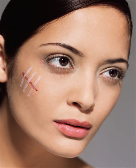 How to Get Rid of Scars—For Good | StyleCaster