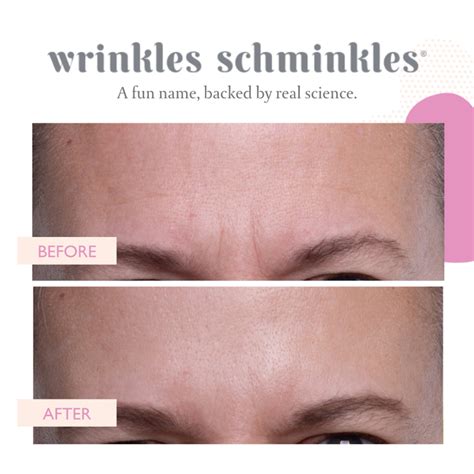 FOREHEAD WRINKLE PATCHES - 2 PATCHES – Melrose Skincare