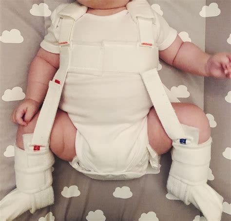 Our Hip Dysplasia journey- from double nappies to the Pavlik Harness – Flicks and Red Lips | Hip ...