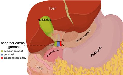 Hepatocellular Carcinoma | Geeky Medics