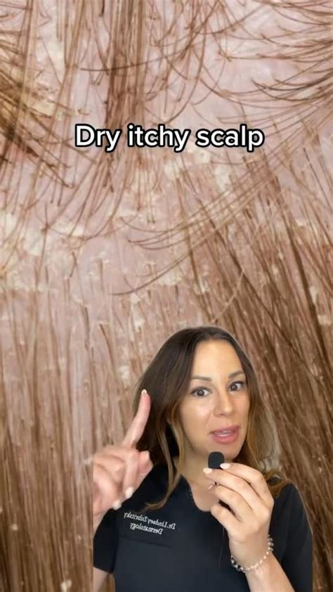 Dermatologist Provides Solutions for a Dry, Itchy Scalp – Derm Explains [Video] | Hair care, Dry ...