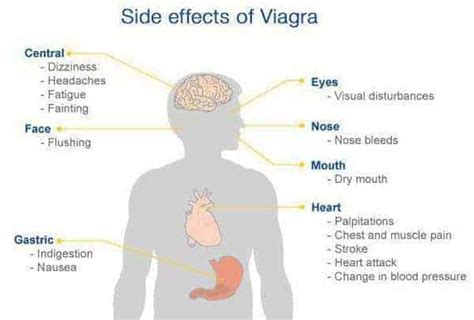 Viagra Side Effects - All You Need To Know About Viagra