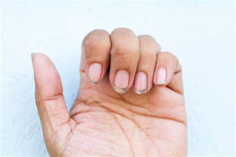 Why Is It Itchy Under My Fingernails? (10 Possible Reasons)