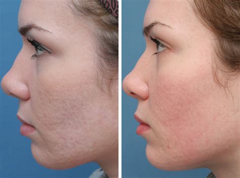 Central Mass Derm | Dermatology Services in Southbridge MA