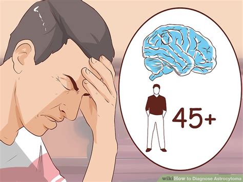 How to Diagnose Astrocytoma: 12 Steps (with Pictures) - wikiHow Health