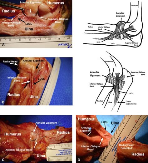 The annular ligament—revisited - Journal of Shoulder and Elbow Surgery