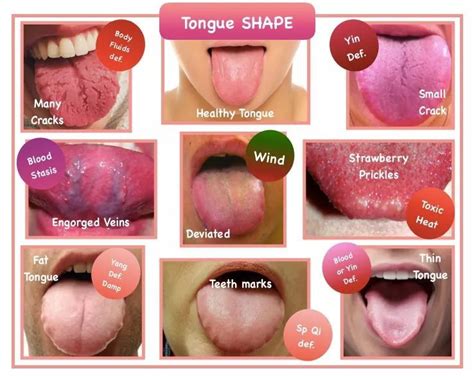 Pin by Jenneke StudioSeiza on TCM diagnose | Healthy tongue, Tongue health, Chinese medicine