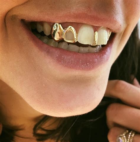 Custom Grillz | Gold Grillz | Diamond Grillz | Custom Jewelry