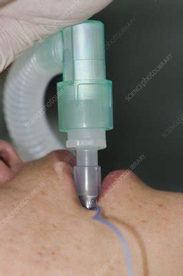 Intubated patient - Stock Image - C014/4763 - Science Photo Library