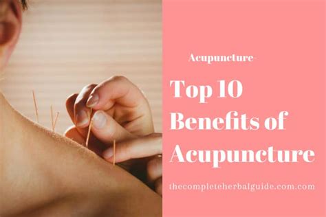 Top 10 Benefits of Acupuncture - Health and Natural Healing Tips