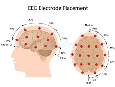 EEG electrode placement stock vector. Illustration of medical - 29444803