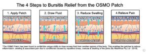 Natural Bursitis Treatment and Remedies | OSMO Patch US