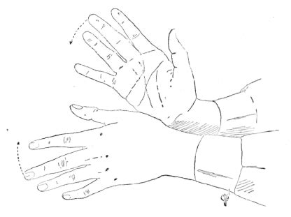 Fig. 8. Hacking. Neuromuscular Therapy, Scientific Articles, Healing ...