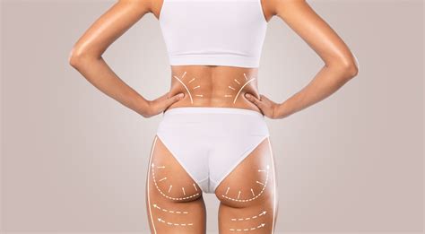 What Influences the Price of a Brazilian Butt Lift Surgery?