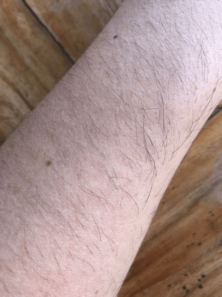 How to Make Arm Hair Less Noticeable | myHIRSUTISM.com