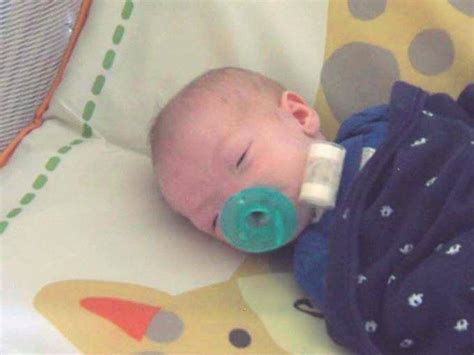 Baby Born with Life-Threatening Condition Left Him Without A Nose ...