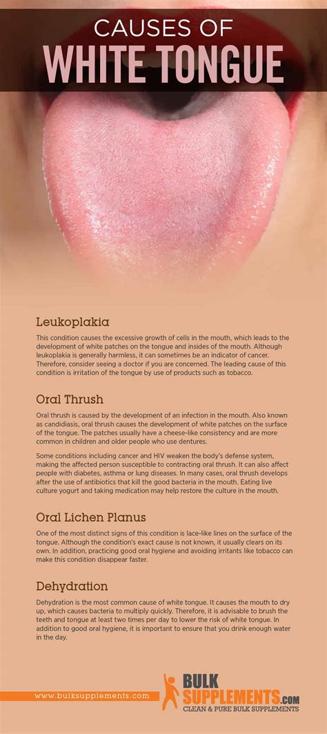 White Lips Sign Dehydration | Lipstutorial.org