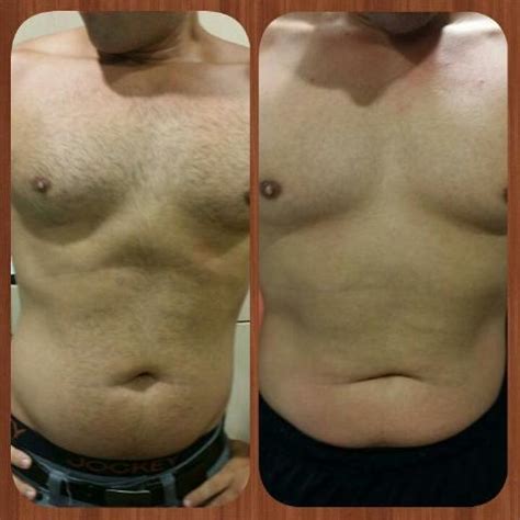 Ultrasonic Cavitation Tampa| Bellissimo You