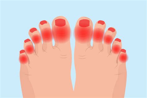 Swollen Painful Toes On One Foot on Sale | emergencydentistry.com