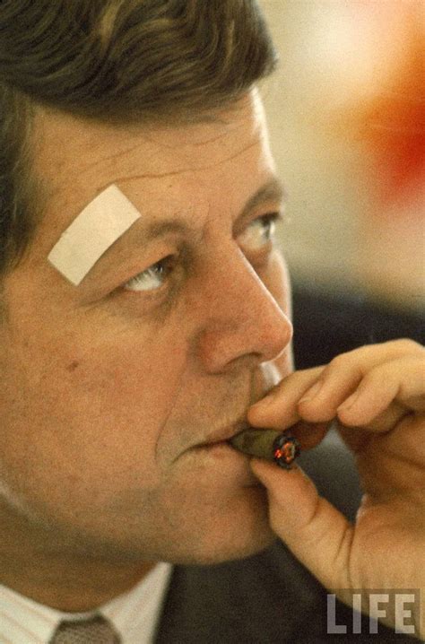 JFK smoking a cigar during White House conference. His bandage covers a ...