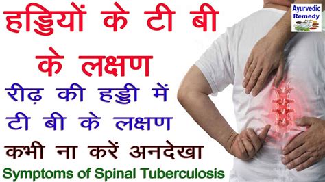 हडि्‌डयों के टीबी के लक्षण | tb symptoms | spinal tb symptoms | bone tb ...