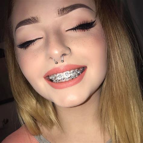 ᴘɪɴᴛᴇʀᴇsᴛ ⋆ ᴊᴏᴜɪʀxʙɪᴛᴄʜ | Brace face, Dental braces, Smiley piercing