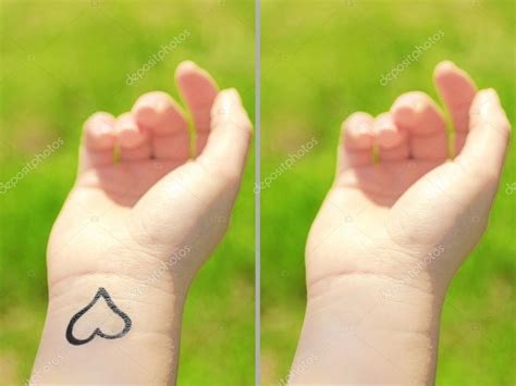 Tattoo Woman Hand Laser Tattoo Removal Concept Stock Photo by ...