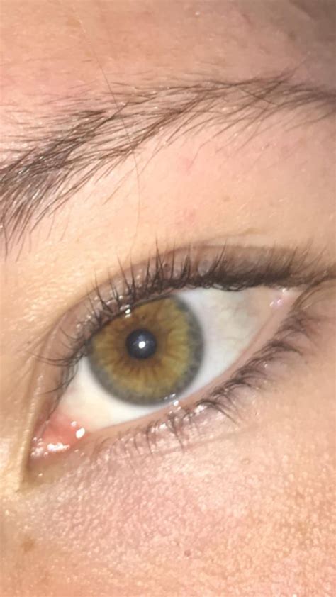 Central Heterochromia or hazel eyes? : r/heterochromia