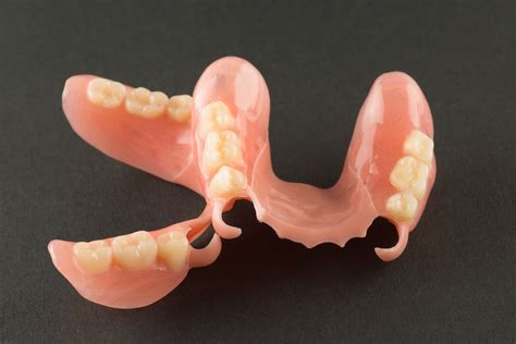 Flexible Partial Denture Upper Front Teeth?