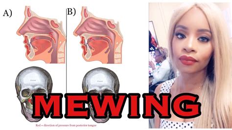 MEWING TONGUE POSTURE TO CHANGE THE SHAPE OF MY FACE? - YouTube