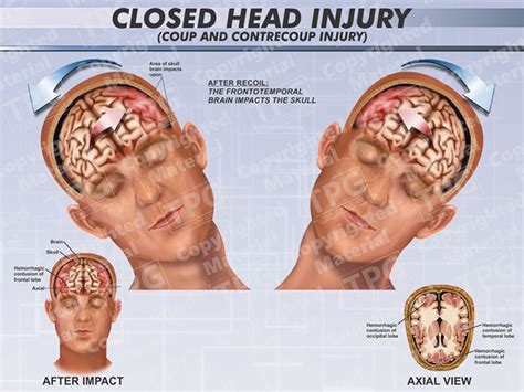 Head Injury - Pictures