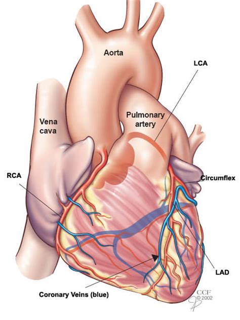 Coronary Artery Disease | Cleveland Clinic