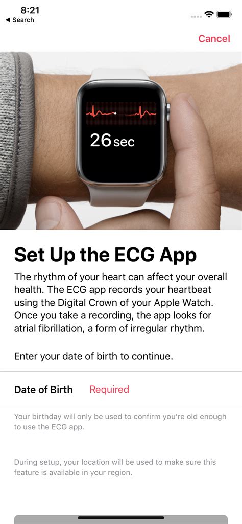 ECG is now available on the Apple Watch in SG and here’s what you need ...