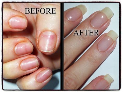 Thelma Baldwin Viral: Do Acrylic Nails Damage Natural Nails