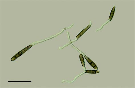 Conidial germination of Bipolaris cactivora at 4 hr, Scale bar 50 μm. | Download Scientific Diagram