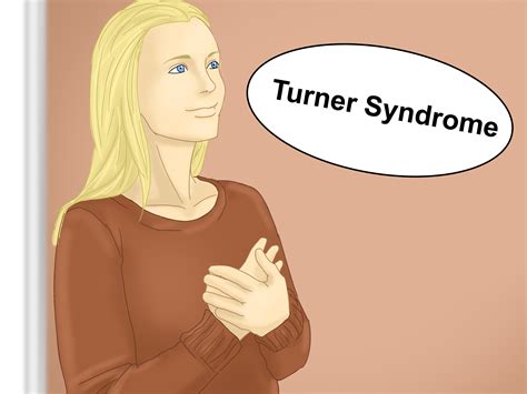 Cómo diagnosticar el síndrome de Turner - Wiki Salud de la mujer