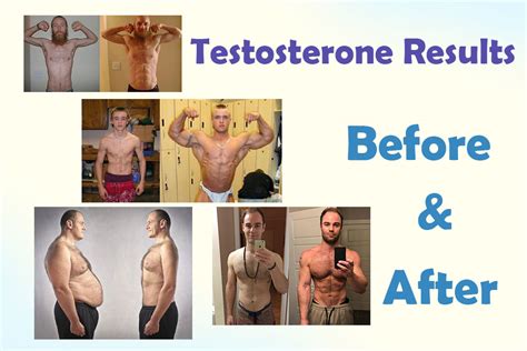 Treatment of Low Testosterone: Before and After - HRTUS