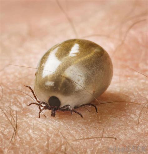 How Do I Remove A Sheep Tick From My Dog - HOWOTREMVO