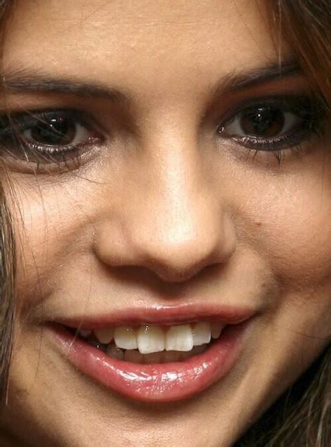 The 411 Dirt: Did You Know Selena Gomez Has VENEERS?! *2019*