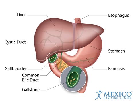 How You Know You Have Gallstones: Signs, Symptoms, & Treatment