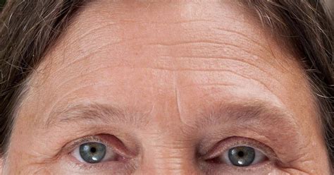 Strengthen Face Skin And Jowls Using Facial Aerobics: Ultimate Brow Furrow Minimization: Employ ...