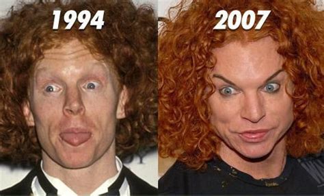 10 Famous Men With Horrible Plastic Surgeries in 2023 | Bad celebrity plastic surgery, Plastic ...