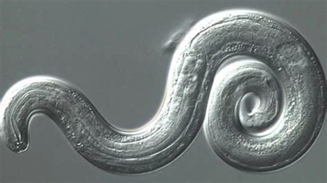 A Deadly Brain-Invading Worm Is Disturbingly Widespread in Florida