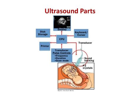 Basics of Ultrasound