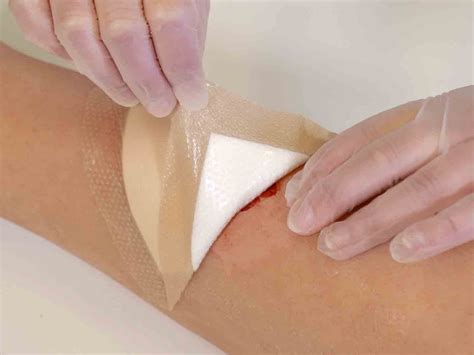 How to change wound dressings | Mölnlycke Advantage