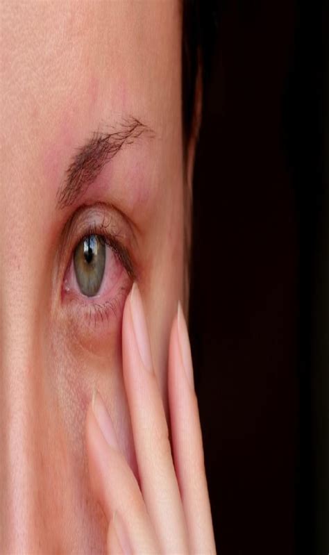 Do you know what causes Madras Eye? — Webtunia - Time News