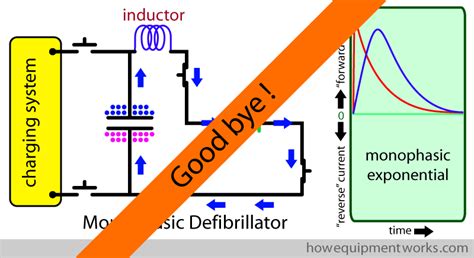 How defibrillators work explained simply - How Equipment Works