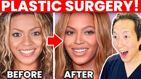 BEYONCÉ Plastic Surgery Transformation – Cosmetic Surgeon Reacts! - Cambridge Breast