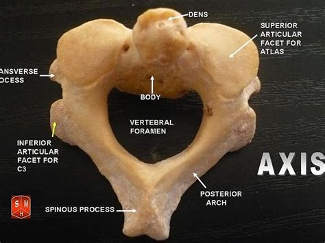 What is the Difference Between Atlas and Axis Vertebrae - Pediaa.Com | Axis vertebra, Vertebrae ...