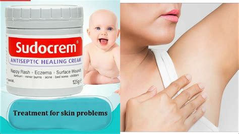 Put Baby Rash Cream On Your Underarm/Armpit And See What Happens - YouTube